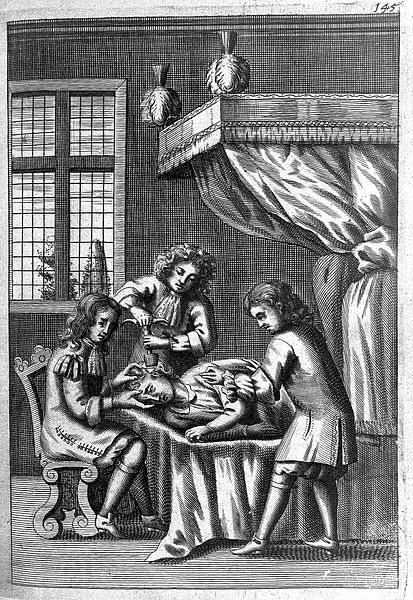 Revolting Remedies - trepanation 