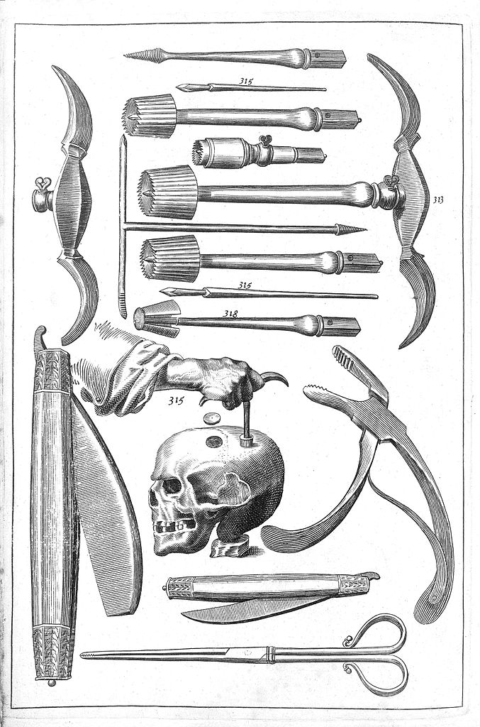 trepanation tools